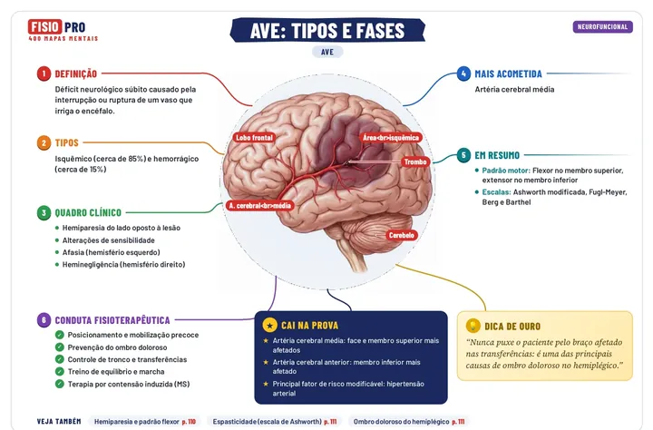 Mapa mental do AVE: definição, tipos, quadro clínico, conduta fisioterapêutica, o que cai na prova e dica de ouro