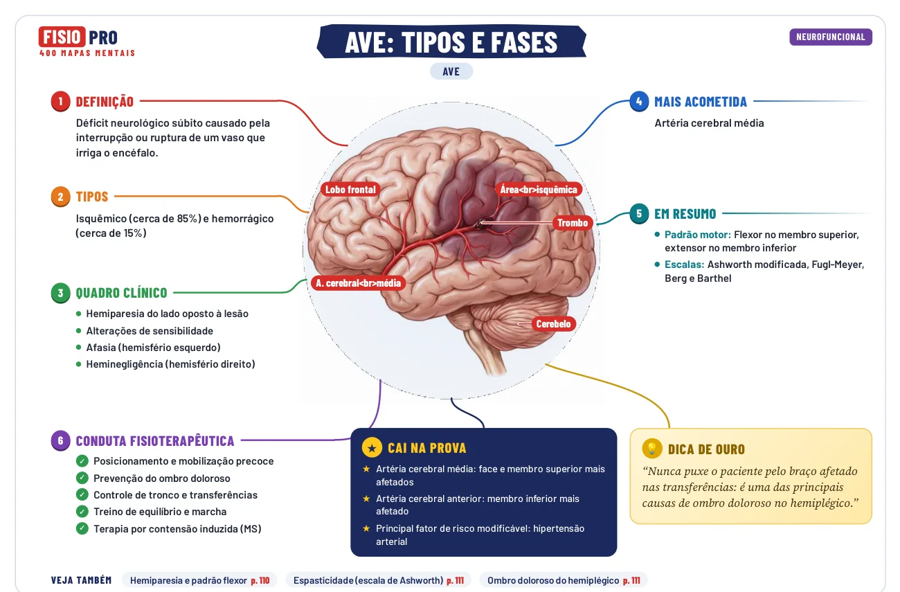 Mapa mental do AVE: definição, tipos, quadro clínico, conduta fisioterapêutica, o que cai na prova e dica de ouro